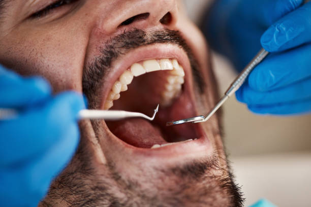 Best Emergency Tooth Extraction  in Chattahoochee, FL