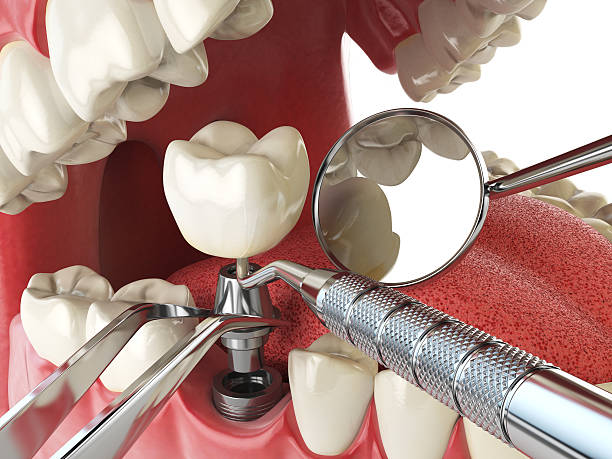 Best Knocked-Out Tooth Emergency  in Chattahoochee, FL